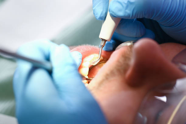 Best Broken or Chipped Tooth Repair in Humansville, MO